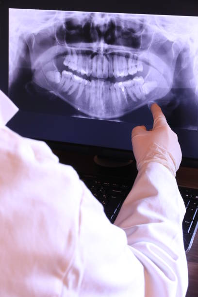 Best Mobile Emergency Dentist in Tehaleh, WA